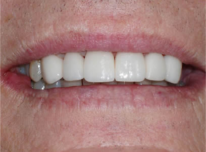 dentist near aventura