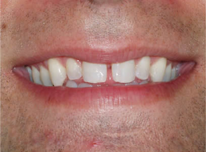 Before & After Smiles – trusted dentist near Aventura
