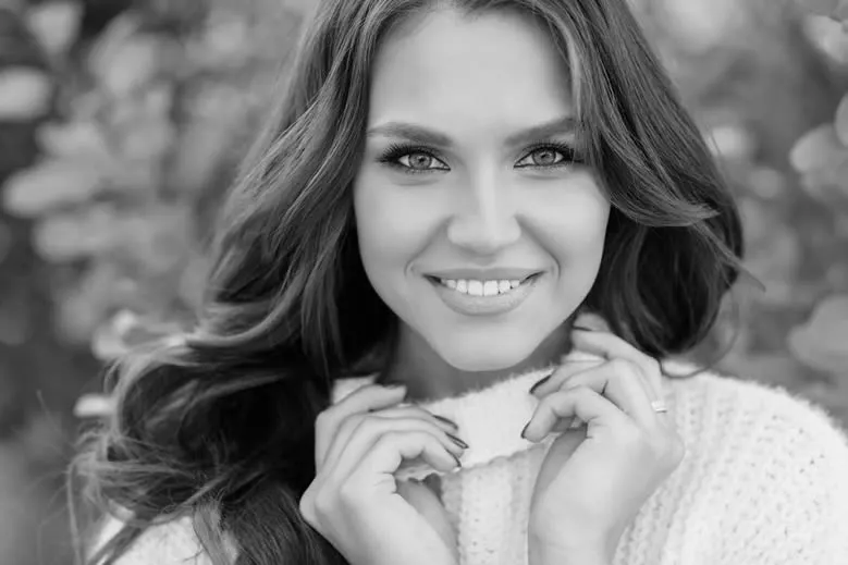 smile makeover smile